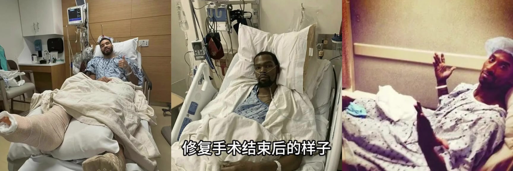 KD最奇科比杜蘭特塔圖姆跟腱斷裂修復(fù)手術(shù)結(jié)束后的樣子
